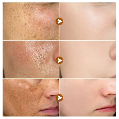 30ml Vitamin B3 Serum Niacinamide Anti-Aging Whitening Dark Spot Remover Moisturizing Korean Cosmetics for Acne And Melasma