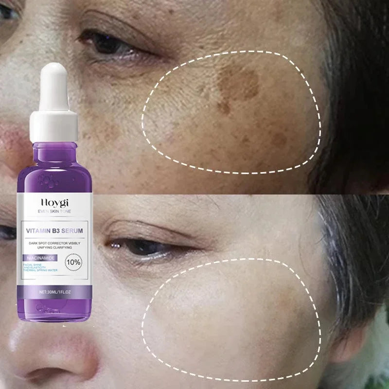 30ml Vitamin B3 Serum Niacinamide Anti-Aging Whitening Dark Spot Remover Moisturizing Korean Cosmetics for Acne And Melasma