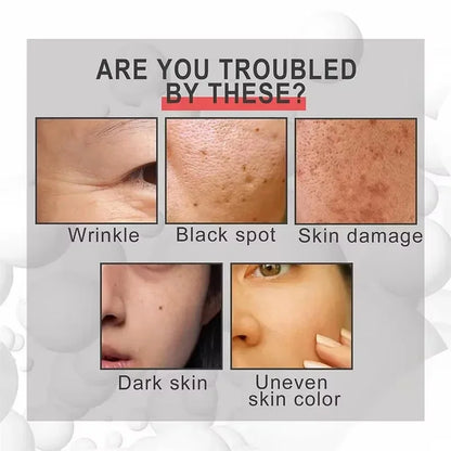 30ml Vitamin B3 Serum Niacinamide Anti-Aging Whitening Dark Spot Remover Moisturizing Korean Cosmetics for Acne And Melasma