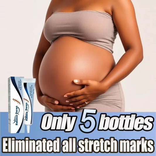 Stretch Marks Remover Cream Pregnancy Maternity Body New Old Stretch Remove Marks Lifting Firming Increase Elasticity Of Skin