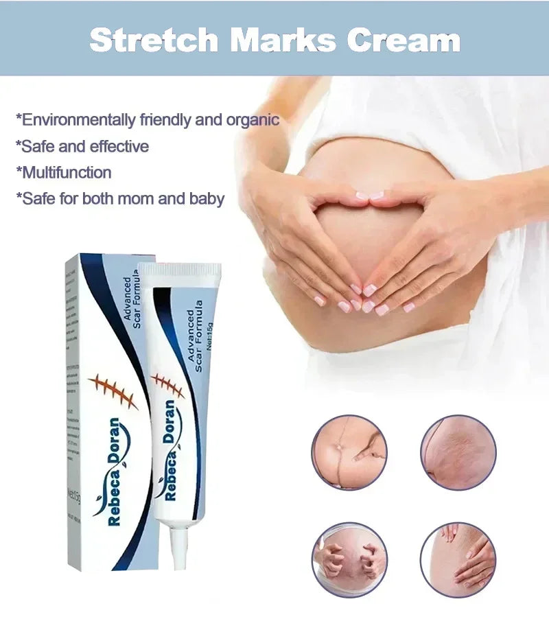 Stretch Marks Remover Cream Pregnancy Maternity Body New Old Stretch Remove Marks Lifting Firming Increase Elasticity Of Skin
