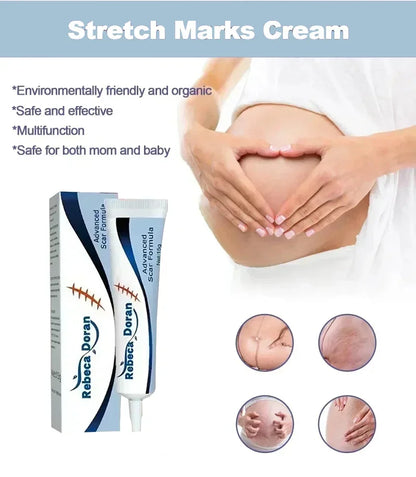 Stretch Marks Remover Cream Pregnancy Maternity Body New Old Stretch Remove Marks Lifting Firming Increase Elasticity Of Skin