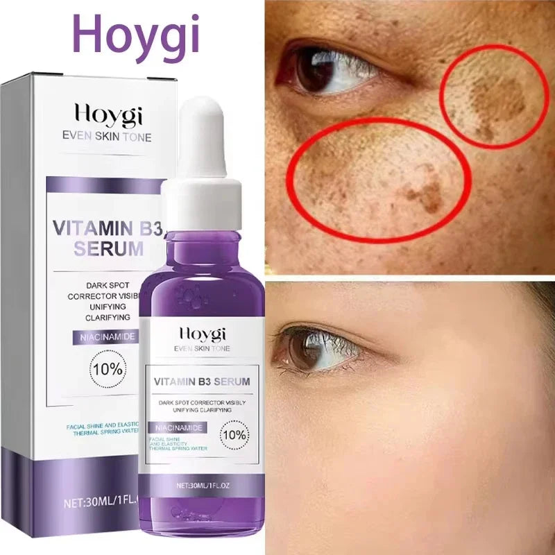 30ml Vitamin B3 Serum Niacinamide Anti-Aging Whitening Dark Spot Remover Moisturizing Korean Cosmetics for Acne And Melasma